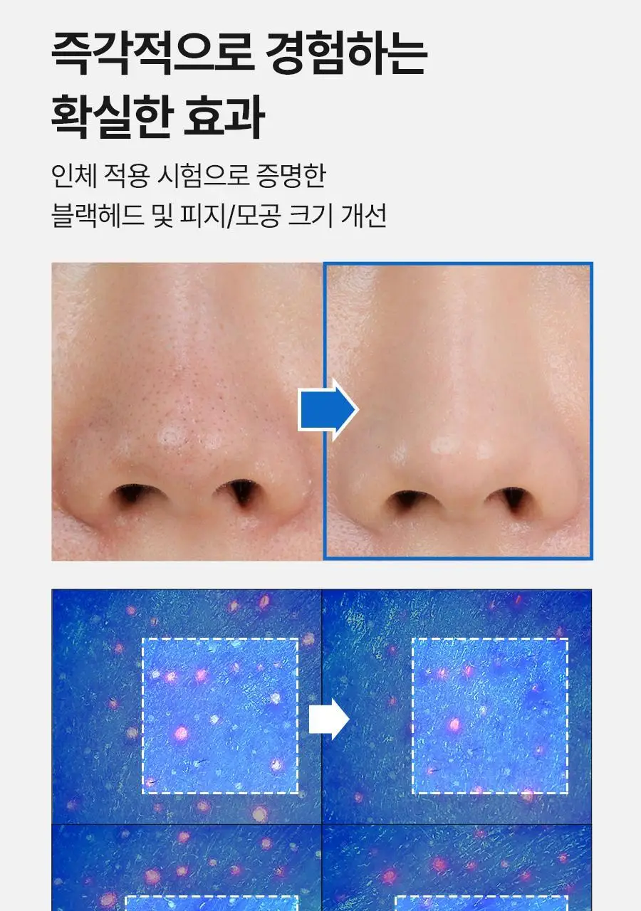 [피지연화코팩] 메디필 엑스트라 슈퍼 9 플러스 블랙헤드 아웃 코팩 5매 상세페이지 18